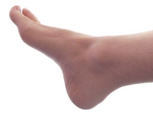 What is Tarsal Tunnel Syndrome?