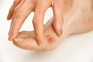 Do I Need Bunion Surgery?